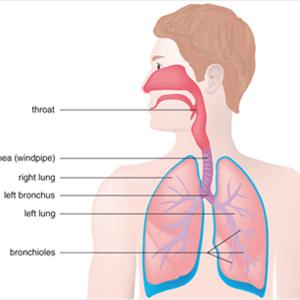  Chronic Bronchitis: