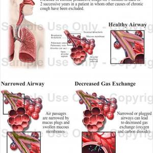 Heal Bron - Symptoms Of Bronchitis Inside Newborns